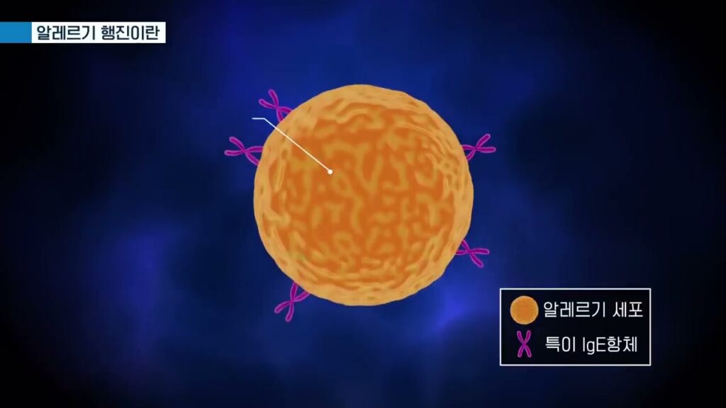 알레르기 비염, 알레르기 행진, 면역요법 1 12 1