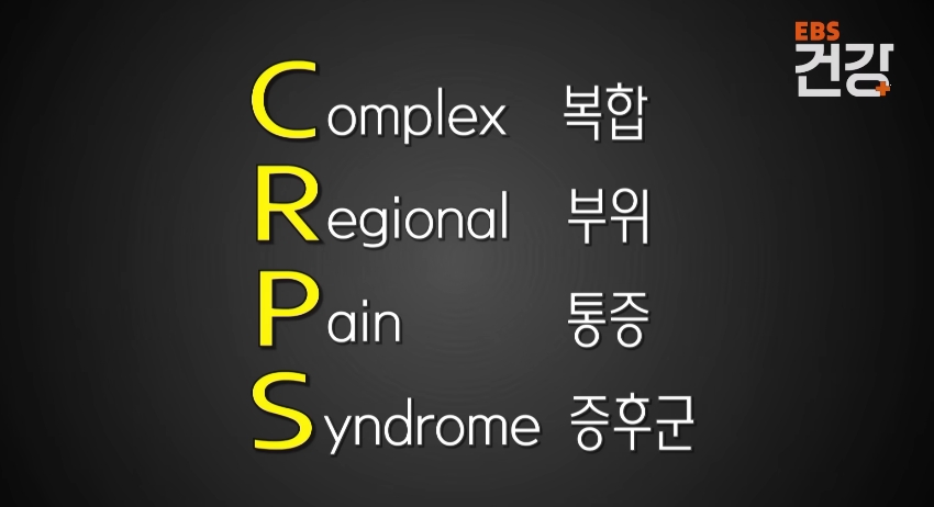 CRPS 복합부위 통증 증후군 1 Capture 2026 0410 141930